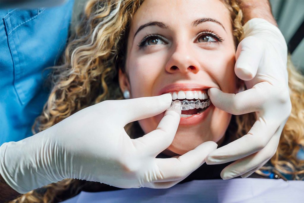 Why-You-Should-Choose-an-Orthodontist-Over-Mail-Order-Aligners-header
